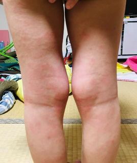 4歳4月中旬足全体.jpg
